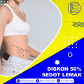 klinik sedot lemak