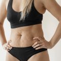 manfaat tummy tuck